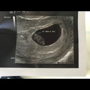 Meet your Posher, Erick